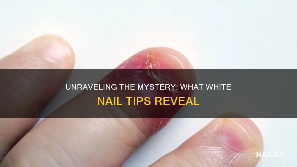 what do very white nail tips mean