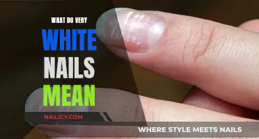 Uncover the Mystery: What Your White Nails Say About Your Health