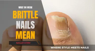 The Health Warning Your Nails May Be Sending