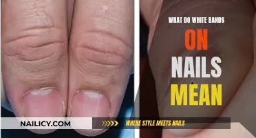 Unraveling the Mystery: White Bands on Your Nails