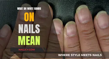 White Bands on Nails: What's the Underlying Health Concern?