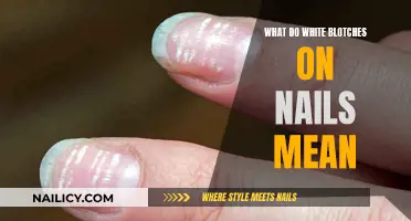 Unraveling the Mystery: White Blotches on Nails