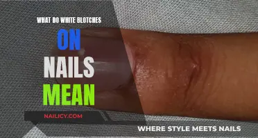 White Blotches on Nails: What Your Body Is Trying to Tell You