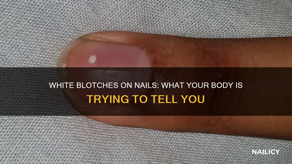 what do white blotches on nails mean