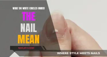 Unraveling the Mystery: White Circles Under Your Nails