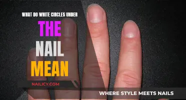 White Circles Under Nails: What's the Meaning?