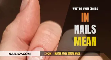 White Clouds on Nails: What Do They Mean?