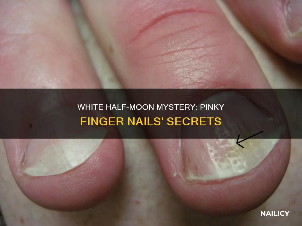 what do white half moon on pinky finger nail mean