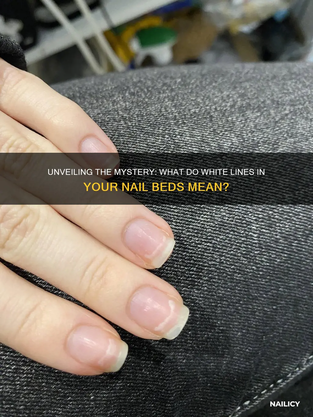 what do white lines in your nail beds mean