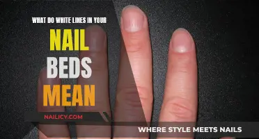 White Lines on Nail Beds: What Do They Indicate?