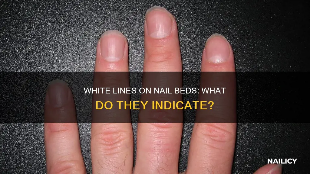 what do white lines in your nail beds mean