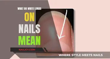 Lunula Exposure: What Do White Lunulas Say About Your Health?