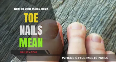 Unraveling the Mystery: White Marks on Your Toenails