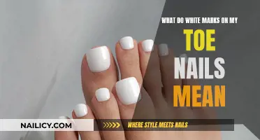 Toe Fungus: White Marks and Their Meaning