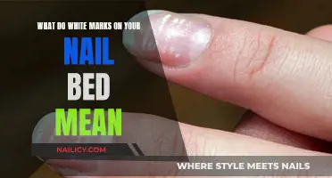 Unraveling the Mystery: White Marks on Your Nails