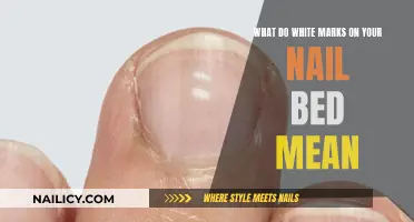 White Marks on Nails: What Your Nail Beds Are Trying to Tell You