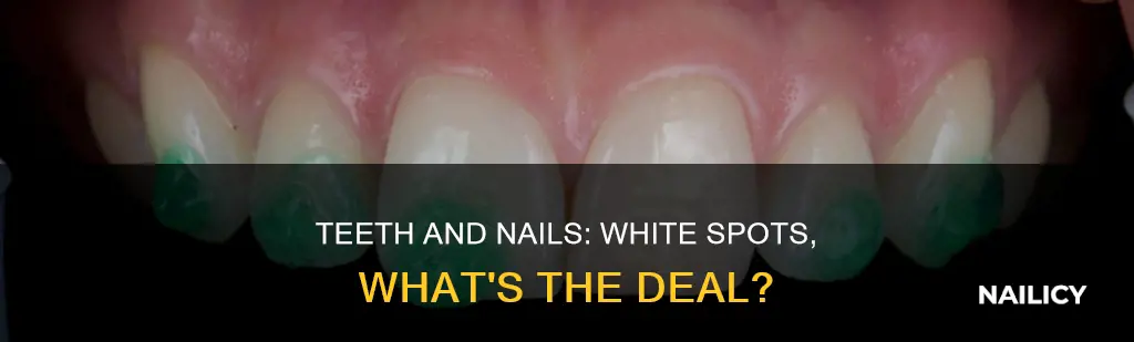what do white spots on teeth and nails mean