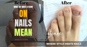 Uncover the Mystery: White Stains on Your Nails