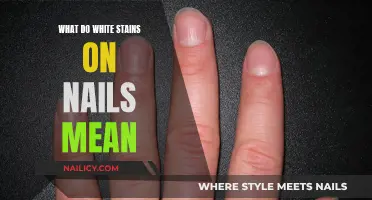White Stains on Nails: What Do They Mean?