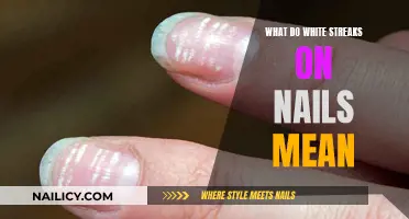 Uncover the Mystery: White Streaks on Your Nails