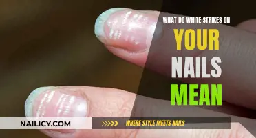 Unraveling the Mystery: White Marks on Your Nails