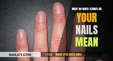 White Nail Streaks: What Do They Mean?