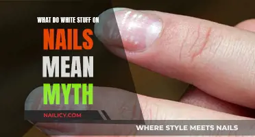 Unraveling the Mystery: White Spots on Nails