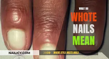 Unraveling the Mystery: What Do White Nails Indicate?