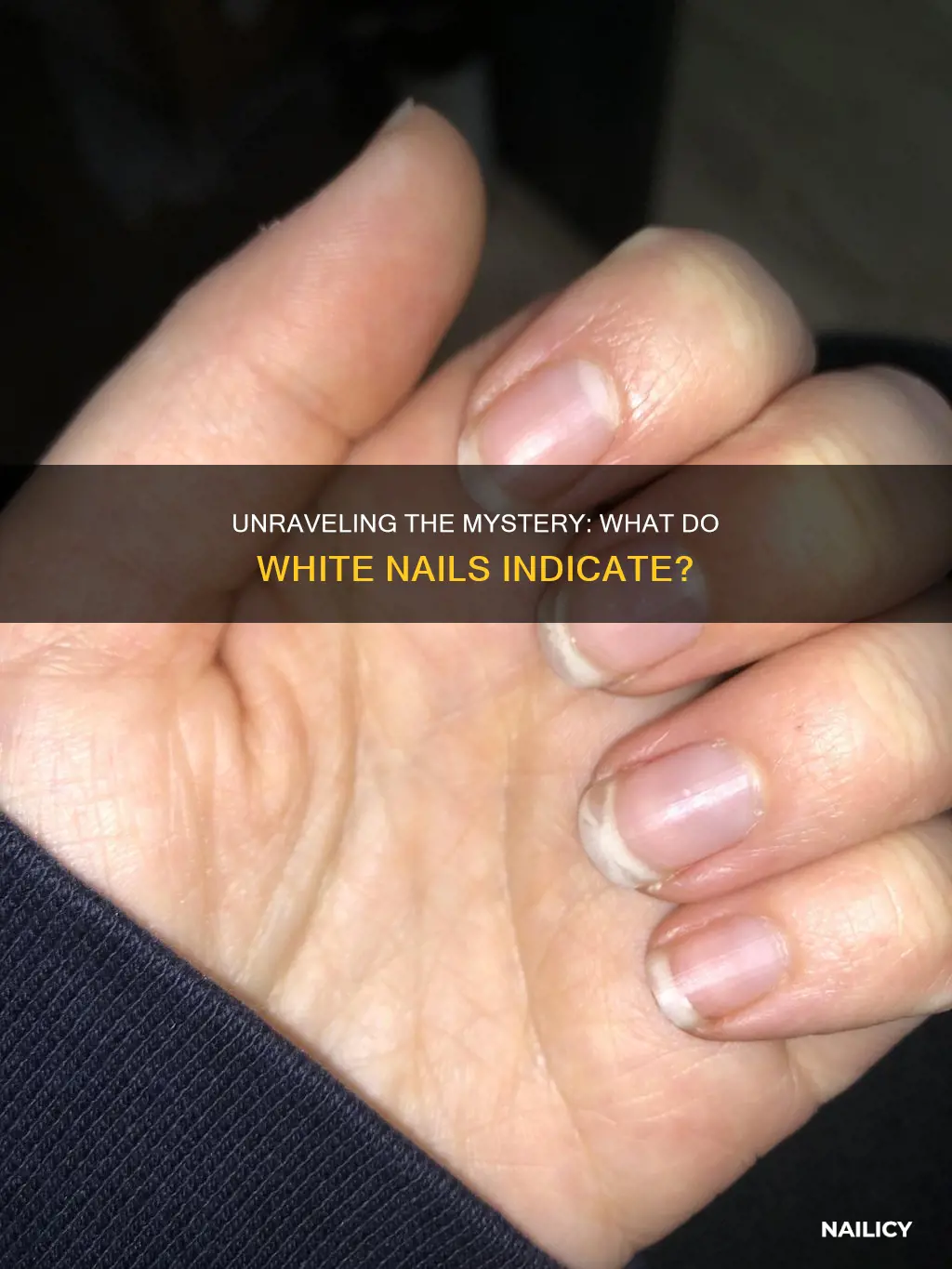 what do whote nails mean