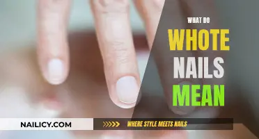 White Nails: What They Mean and Why They Happen