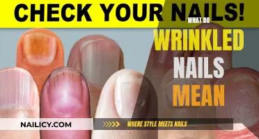 Unraveling the Mystery: What Your Wrinkled Nails Reveal