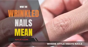 Wrinkled Nails: What Do They Mean for Your Health?