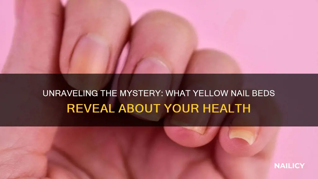 what do yellow nail beds mean