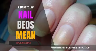 Yellow Nail Beds: What Do They Indicate About Your Health?
