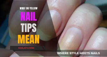 Unraveling the Mystery: What Your Yellow Nail Tips Say About You