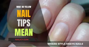 Yellow Nail Tips: What Do They Mean?