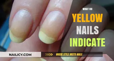 Unveiling the Secrets: What Yellow Nails Reveal About Your Health