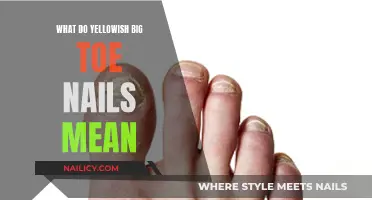 Yellowish Big Toe Nails: What Do They Indicate?