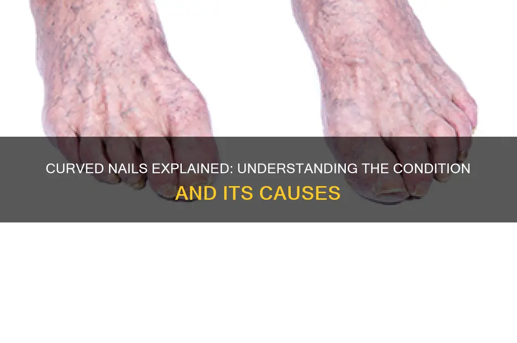 what do you call nail that curves