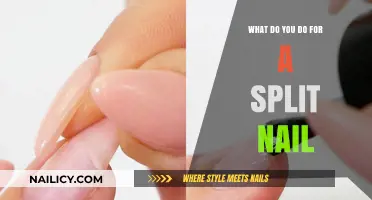 Quick Fixes for Split Nails: Repair and Prevent Breakage Easily