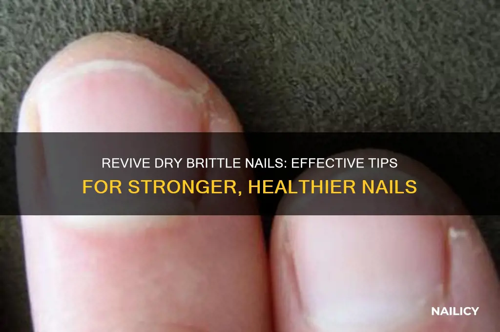 what do you do for dry brittle nails