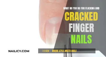 Fixing Flaky, Cracked Nails: Quick Tips for Healthy Hands