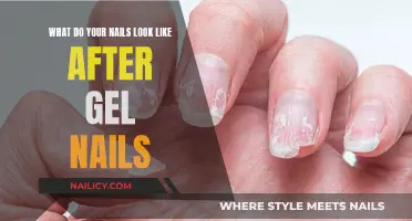 Gel Nails: The After-Effects and Your Natural Nails