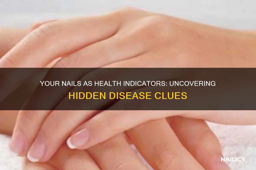 what do your nails say about desease