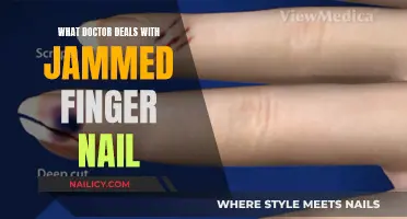 The Surprising Specialist: Who Fixes Jammed Finger Nails?