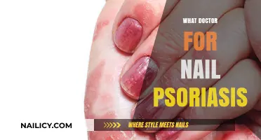 Finding Relief: Which Doctor Can Help with Nail Psoriasis?