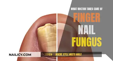 Treating Stubborn Nail Fungus: Which Doctor Should You Consult?