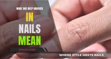 Deep Nail Grooves: What Your Nails Are Trying to Tell You