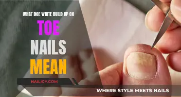 White Nail Build-Up: Understanding the Possible Causes and Treatments