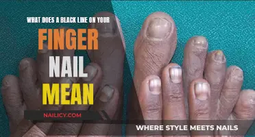 Unraveling the Mystery: Black Line on Your Finger Nail